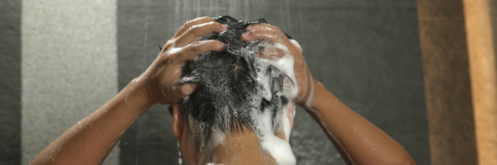 Best Shampoos For Dandruff